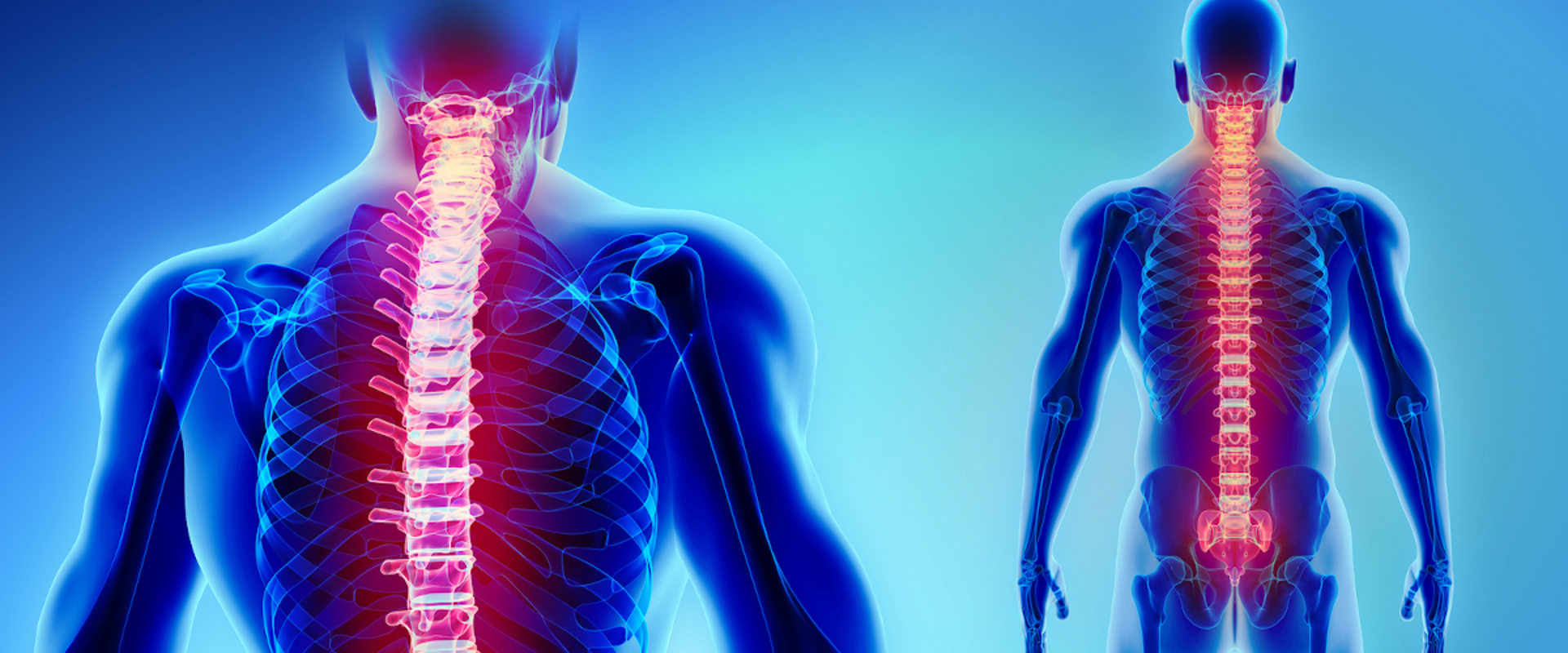 What back injury causes paralysis?