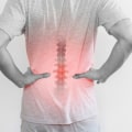The Overlooked Impact of Stress Hormones on Back Injury Pain