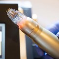 From Back Injury Recovery to Skin Renewal: Exploring Sylfirm X in Zürich