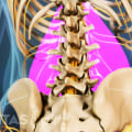 What diseases cause back pain?