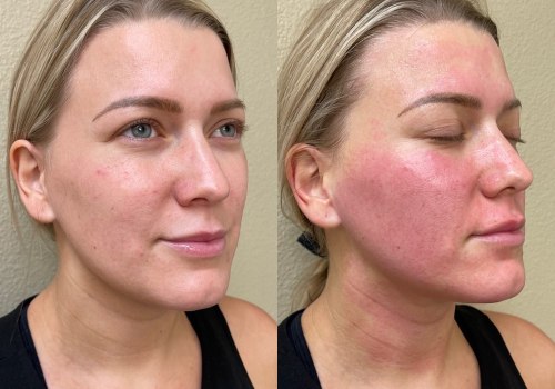 From Recovery To Renewal: Plastic Surgery In Danville, California After Back Injury Challenges