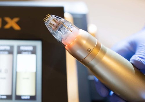 From Back Injury Recovery to Skin Renewal: Exploring Sylfirm X in Zürich